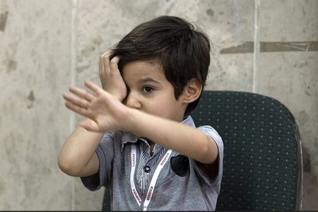 شناسایی ۳۱۷۷ کودک مبتلا به تنبلی چشم در قزوین